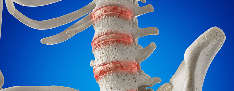 patient needing degenerative disc disease relief in Charlotte NC