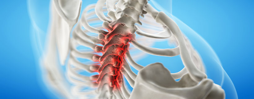 patient needing Spinal Stenosis relief in Charlotte NC